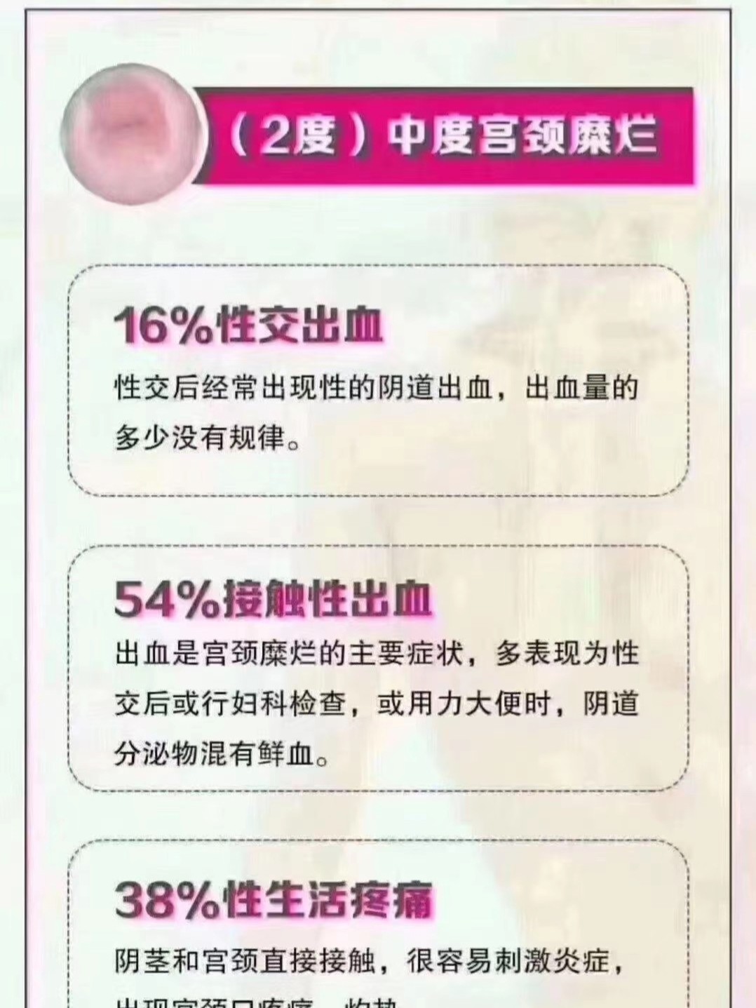 宮頸糜爛幾度會(huì)引發(fā)流血及其相關(guān)解析，宮頸糜爛引發(fā)流血的幾度及相關(guān)解析探討