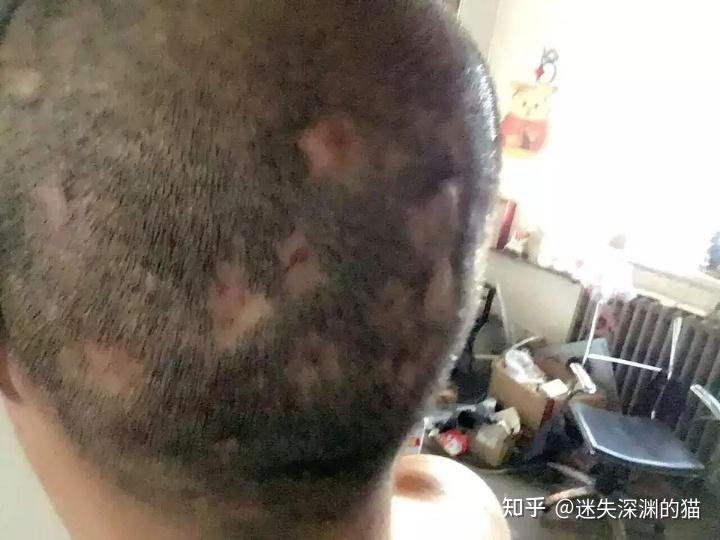 第37頁